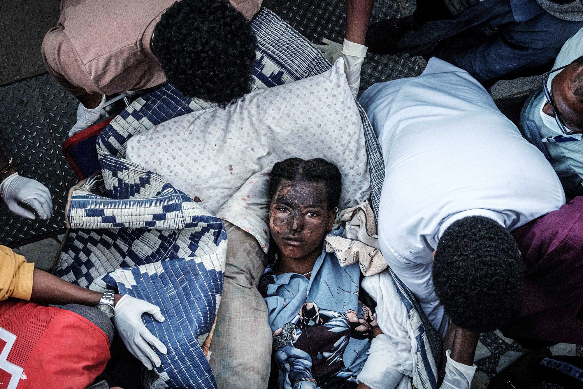 An injured resident of Togoga arrives on a stretcher to the Ayder referral hospital in Mekele, Ethiopia, on June 23, a day after a deadly airstrike on a market in Ethiopia's war-torn northern Tigray region